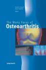 Image for The Many Faces of Osteoarthritis