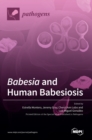 Image for Babesia and Human Babesiosis