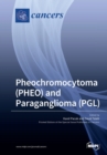 Image for Pheochromocytoma (PHEO) and Paraganglioma (PGL)