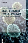 Image for Malignant lymphomas  : biology and molecular pathogenesis