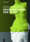 Image for Erkrankungen der Vulva