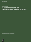 Image for A Colour Atlas of Traditional Meniscectomy