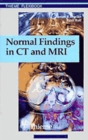 Image for Normal Findings in CT and MRI, A1, print