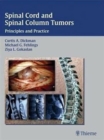 Image for Spinal Cord and Spinal Column Tumors
