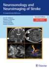 Image for Neurosonology and neuroimaging of stroke  : a comprehensive reference