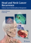 Image for Head and Neck Cancer Recurrence