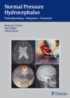 Image for Normal pressure hydrocephalus  : pathophysiology, diagnosis, treatment