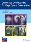 Image for Corrective osteotomies for rigid spinal deformities