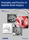 Image for Principles and Practice of Keyhole Brain Surgery