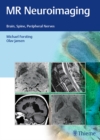 Image for MR neuroimaging  : brain, spine, peripheral nerves