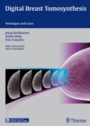 Image for Digital breast tomosynthesis  : technique and cases