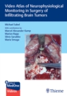 Image for Video Atlas of Neurophysiological Monitoring in Surgery of Infiltrating Brain Tumors