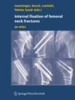 Image for Internal fixation of femoral neck fractures