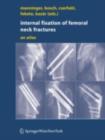 Image for Internal fixation of femoral neck fractures: An Atlas