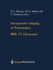 Image for Intraoperative Imaging in Neurosurgery