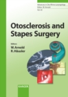 Image for Otosclerosis and Stapes Surgery