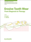 Image for Erosive tooth wear: from diagnosis to therapy