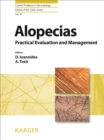Image for Alopecias: practical evaluation and management