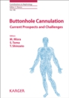Image for Buttonhole cannulation: current prospects and challenges