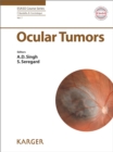 Image for Ocular tumors