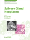 Image for Salivary gland neoplasms