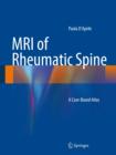 Image for MRI of Rheumatic Spine