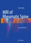 Image for MRI of Rheumatic Spine: A Case-Based Atlas