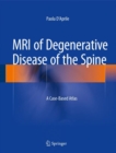 Image for MRI of Degenerative Disease of the Spine
