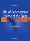 Image for MRI of Degenerative Disease of the Spine: A Case-Based Atlas