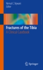 Image for Fractures of the Tibia: A Clinical Casebook