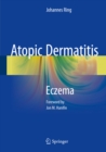 Image for Atopic Dermatitis: Eczema
