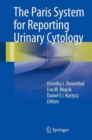 Image for The Paris system for reporting urinary cytology