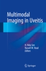 Image for Multimodal Imaging in Uveitis
