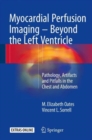Image for Myocardial Perfusion Imaging - Beyond the Left Ventricle