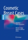 Image for Cosmetic breast cases  : results of online discussions