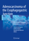 Image for Adenocarcinoma of the Esophagogastric Junction: From Barrett&#39;s Esophagus to Cancer