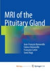 Image for MRI of the Pituitary Gland