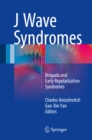 Image for J wave syndromes: Brugada and early repolarization syndromes