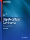 Image for Hepatocellular carcinoma: diagnosis and treatment