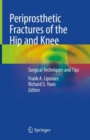 Image for Periprosthetic fractures of the hip and knee  : surgical techniques and tips