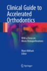 Image for Clinical Guide to Accelerated Orthodontics: With a Focus on Micro-Osteoperforations