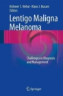 Image for Lentigo Maligna Melanoma
