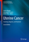 Image for Uterine Cancer: Screening, Diagnosis, and Treatment