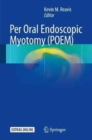 Image for Per Oral Endoscopic Myotomy (POEM)