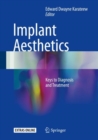 Image for Implant Aesthetics: Keys to Diagnosis and Treatment