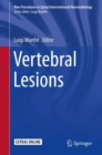 Image for Vertebral lesions