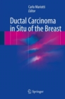 Image for Ductal Carcinoma in Situ of the Breast