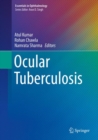 Image for Ocular Tuberculosis