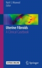 Image for Uterine Fibroids