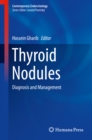 Image for Thyroid Nodules: Diagnosis and Management